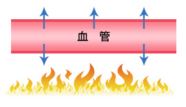 炎症による浸出液