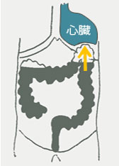 ガス腹が原因で不整脈がおきている？