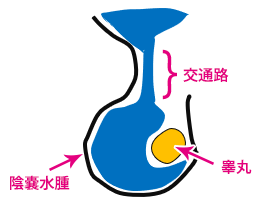 画像 いんのう水腫