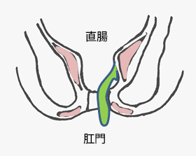 脱肛