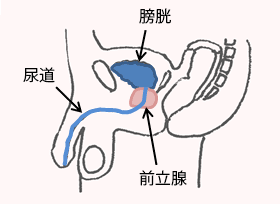 慢性前立腺炎